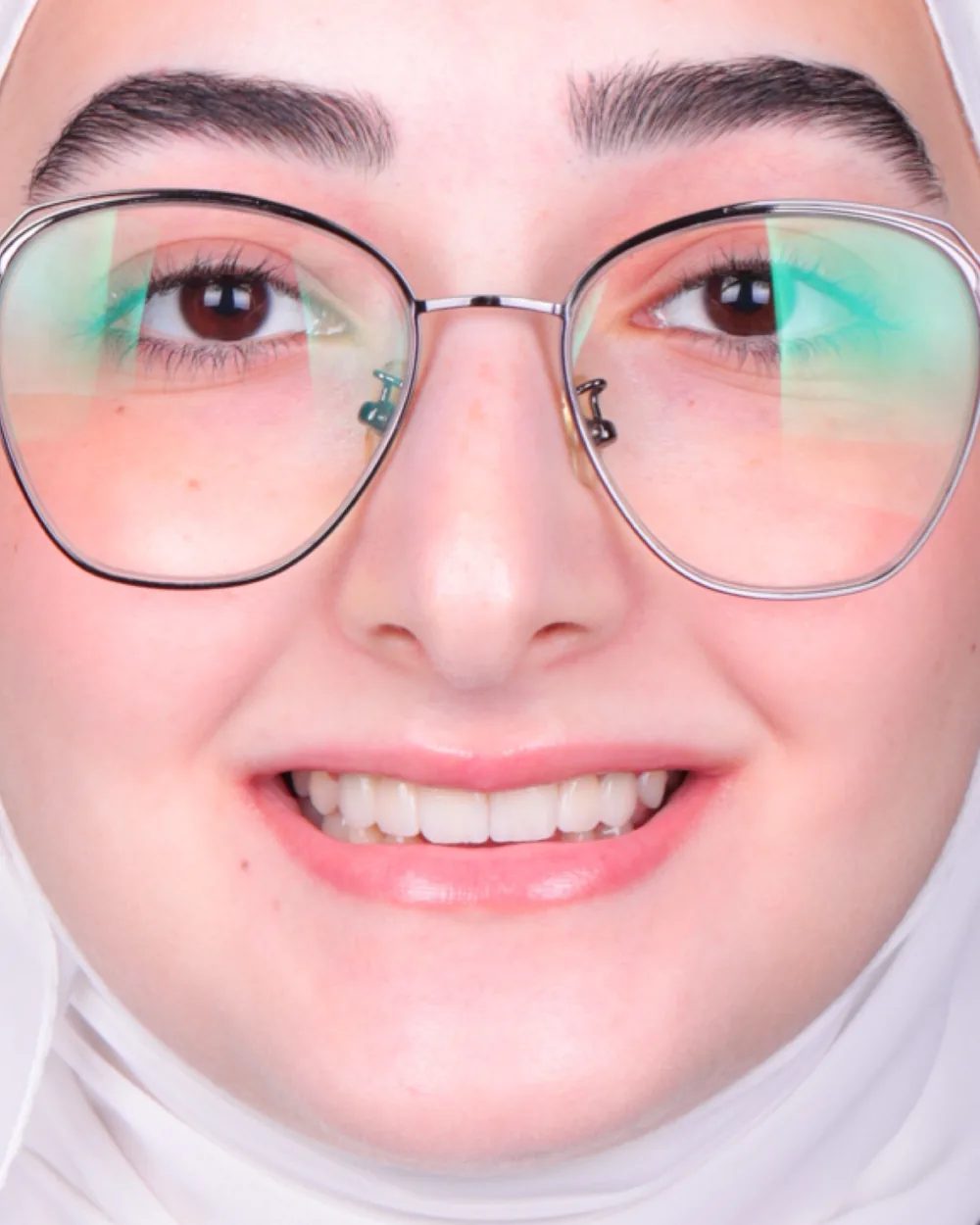 الحالة الرابعة بعد العلاج