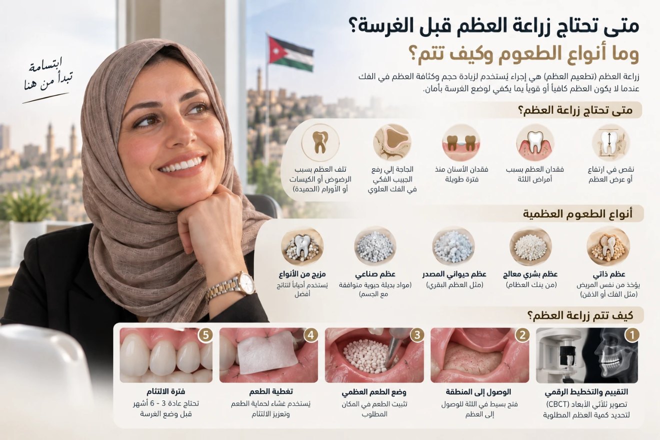 إنفوغرافيك بالعربية: متى تحتاج زراعة العظم قبل الغرسة، أنواع الطعوم العظمية، وخطوات الإجراء الخمس، بجانب سيدة تبتسم وخلفها عمّان